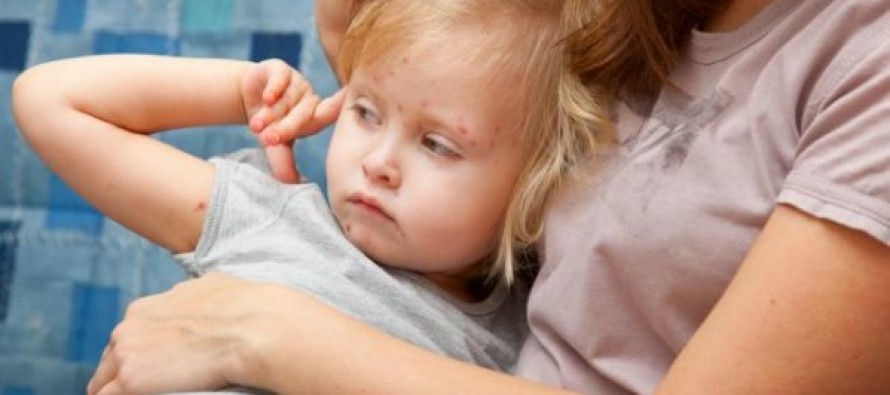 Los pediatras piden la vuelta de la vacuna de la varicela