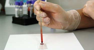 Un análisis de sangre podría diagnosticar el cáncer de manera precoz