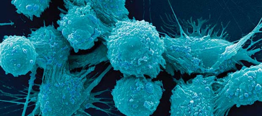 La inmunoterapia es ya una realidad para algunos tumores