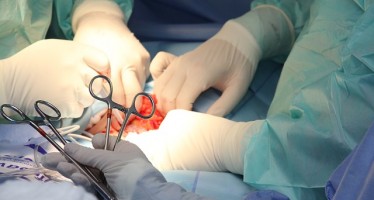 Los pacientes no deben ser depilados entes de una cirugía