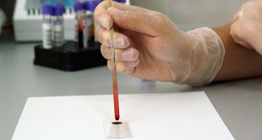Un kit de ADN permite diagnosticar el cáncer mediante un análisis de sangre