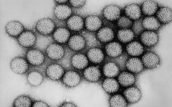 La enfermedad celiaca podría tener relación con un tipo de virus