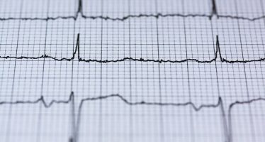 El electrocardiograma en la prevención de la muerte súbita en jóvenes