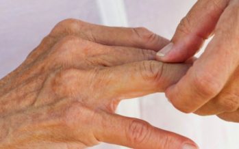 XII Simposio de la Sociedad Española de Reumatología sobre la artritis reumatoide