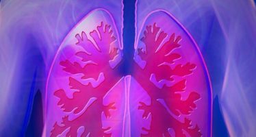 Un estudio identifica un nuevo objetivo molecular para tratar la fibrosis pulmonar idiopática