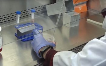 Investigadores descubren un mecanismo que controla la aparición del cáncer de hígado