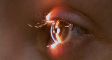 III Curso Básico de Actualización en Cirugía Plástica Ocular