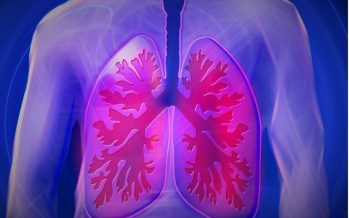 BMS anuncia resultados positivos del ensayo de fase 3 CheckMate‑9LA para pacientes con cáncer de pulmón no microcítico