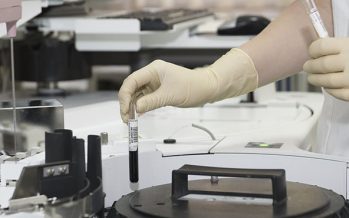 El CNIO prueba que la terapia génica con telomerasa no aumenta el riesgo de cáncer