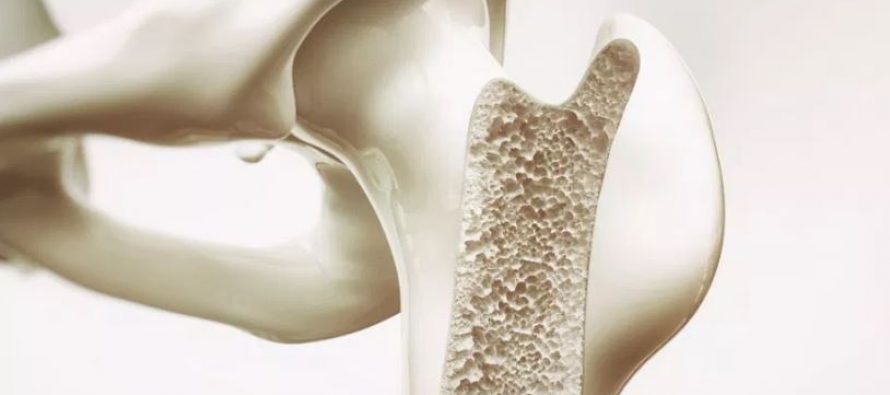 ¿Cuáles son los síntomas de la osteomielitis?