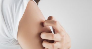 Leo Pharma lanza “¿Sabes lo que mi piel no muestra?” para concienciar sobre psoriasis