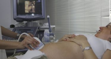 Malformaciones fetales: La ecografía 5D incrementa su detección