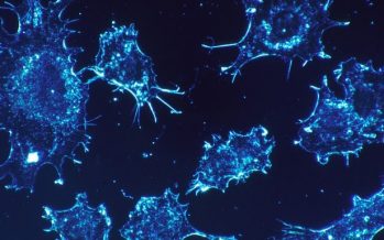 Investigadores identifican un marcador pronóstico en el cáncer de recto basado en el microbioma intestinal