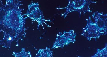 Las células inmunes de la alergia atacan también el cáncer