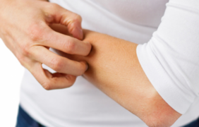 Dermatitis atópica: Sanofi publica la primera guía sobre convivencia con personas con esta enfermedad