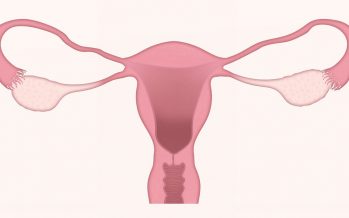 Cáncer de Ovario: Es el quinto tumor más mortal entre las mujeres