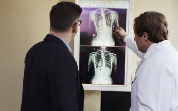 Osteoporosis: Más del 25% de los hombres de 35 a 50 años de edad corre riesgo de esta patología