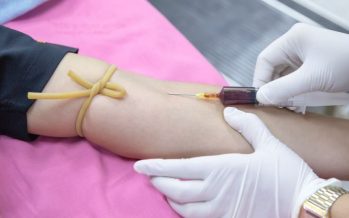 Cáncer de colon: Un test de sangre podría detectarlo 15 años antes de que aparezcan síntomas
