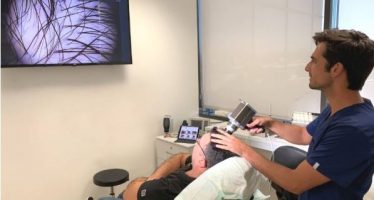 Incorporan un software pionero en Andalucía en el diagnóstico capilar y la planificación para el implante de pelo en Quirónsalud Málaga