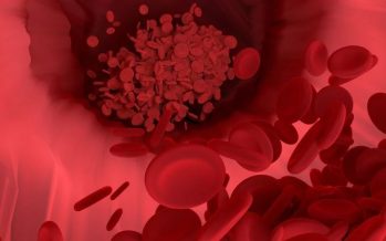 ¿Cuáles son los síntomas de la anemia?