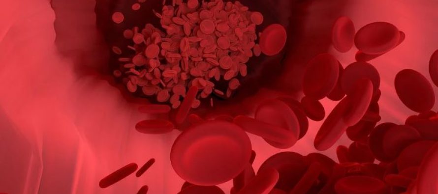 ¿Cuáles son los síntomas de la anemia?
