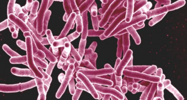 Tuberculosis: podría causar más de un millón de muertes de aquí a cinco años