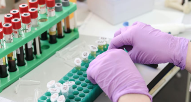 España realiza más de tres millones de PCR desde el inicio de la epidemia por Covid-19