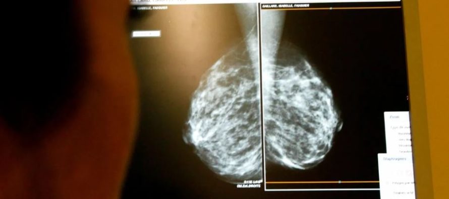 Investigan un nuevo tratamiento para el cáncer de mama resistente a la terapia hormonal