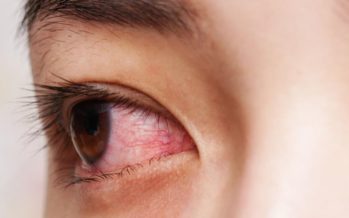 El 30% de pacientes de Covid-19 presenta alteraciones oculares, principalmente conjuntivitis