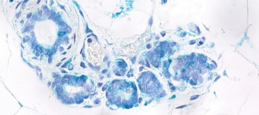 Localizan una conexión entre senescencia y células madre provocada por una proteína iniciadora del cáncer de mama