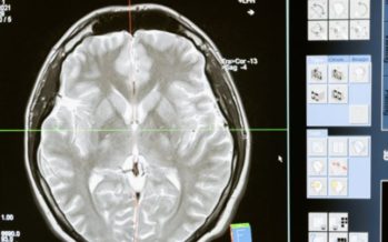 Epilepsia: Entre el 5%-10% de la población experimentará una crisis a lo largo de su vida