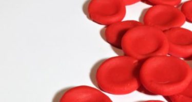 ¿Puede la anemia aumentar el riesgo de enfermedad cardiaca?