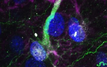 Enfermedades neurodegenerativas: Atacan a las células madre del cerebro e impiden generar nuevas neuronas