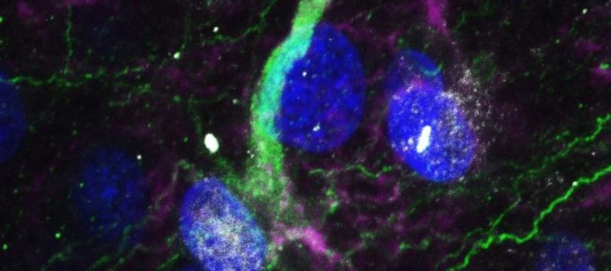 Enfermedades neurodegenerativas: Atacan a las células madre del cerebro e impiden generar nuevas neuronas