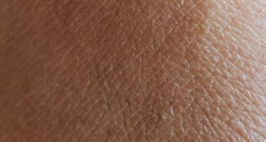 La niacinamida, el ingrediente que querrás para dar vida a tu piel