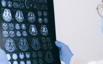 Investigadores dan con la llave que puede frenar el tumor cerebral más agresivo