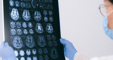 Investigadores dan con la llave que puede frenar el tumor cerebral más agresivo