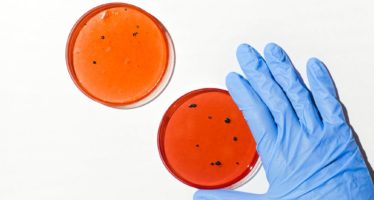 Las bacterias intestinales dañinas boicotean la inmunoterapia en pacientes con cáncer
