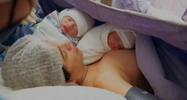 Los gemelos suelen ocurrir en alrededor del 1 al 3% de todos los nacimientos