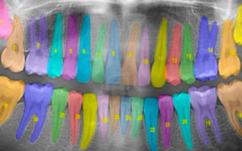 Inteligencia artificial para una medicina periodontal de precisión