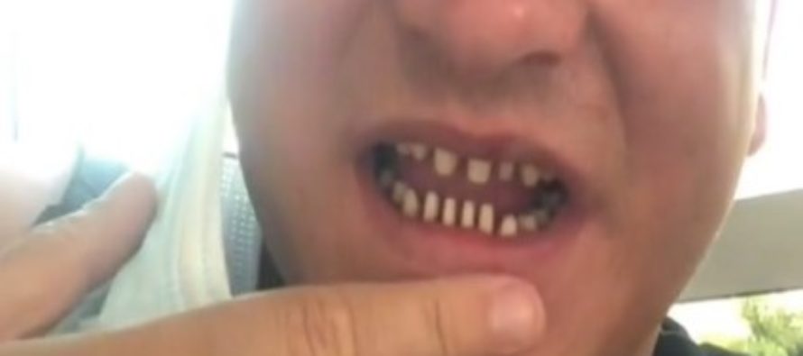 El Consejo General de Dentistas alerta sobre el TurkeyTeeth