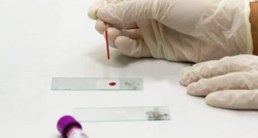 Crear ‘plaquetas de diseño’ para combatir la escasez de sangre