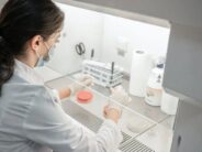 Identifican una huella de mayor riesgo tumoral detectable en el microbioma