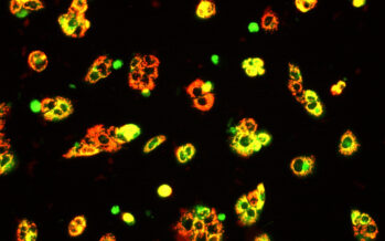 Microgeles con nanopartículas de oro que permiten diagnosticar tumores