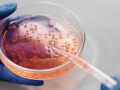 Nuevas pistas sobre la relación entre las bacterias intestinales y el cáncer antes de los 50 años