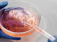 Nuevas pistas sobre la relación entre las bacterias intestinales y el cáncer antes de los 50 años