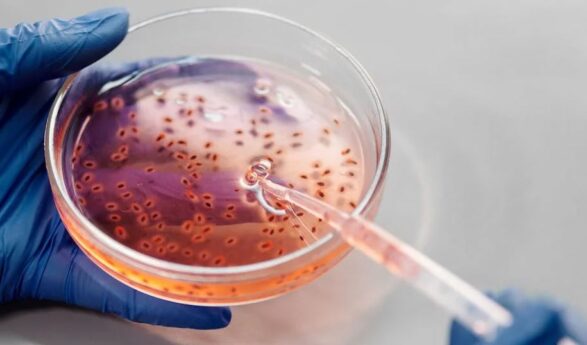 Nuevas pistas sobre la relación entre las bacterias intestinales y el cáncer antes de los 50 años