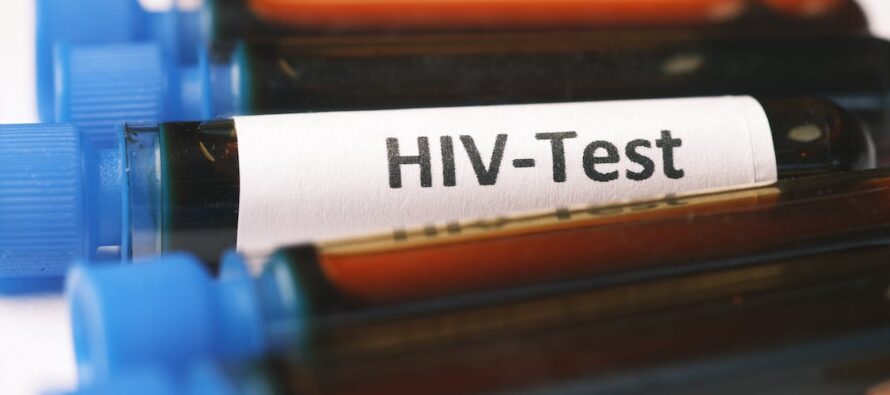 Nuevo tratamiento podría eliminar el VIH en las personas afectadas