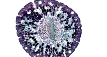 Las células madre en la enfermedad de Crohn