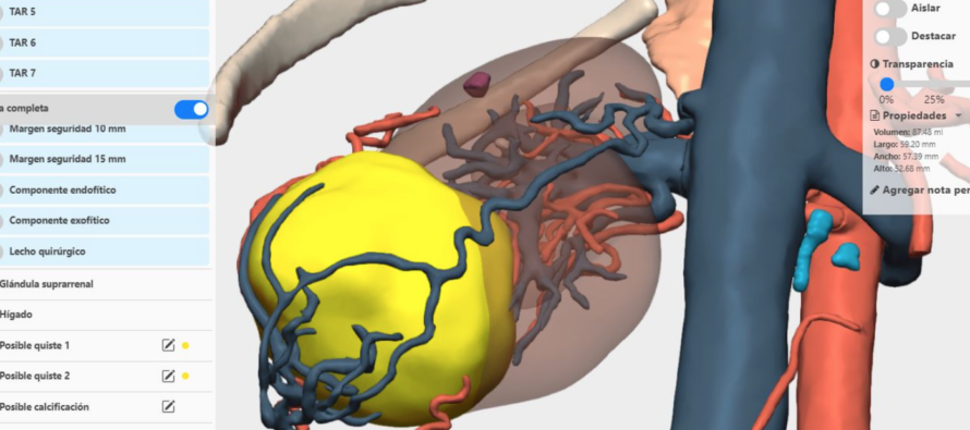 La integración de la IA en modelos 3D permitirá detectar anomalías congénitas en niños